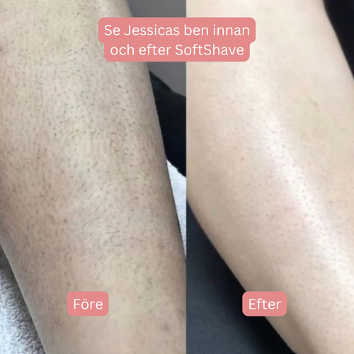 SoftShave™ - För en felfri, len hud utan irritation