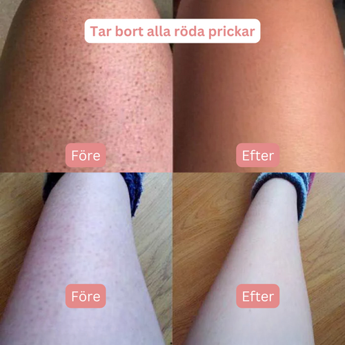 SoftShave™ - För en felfri, len hud utan irritation