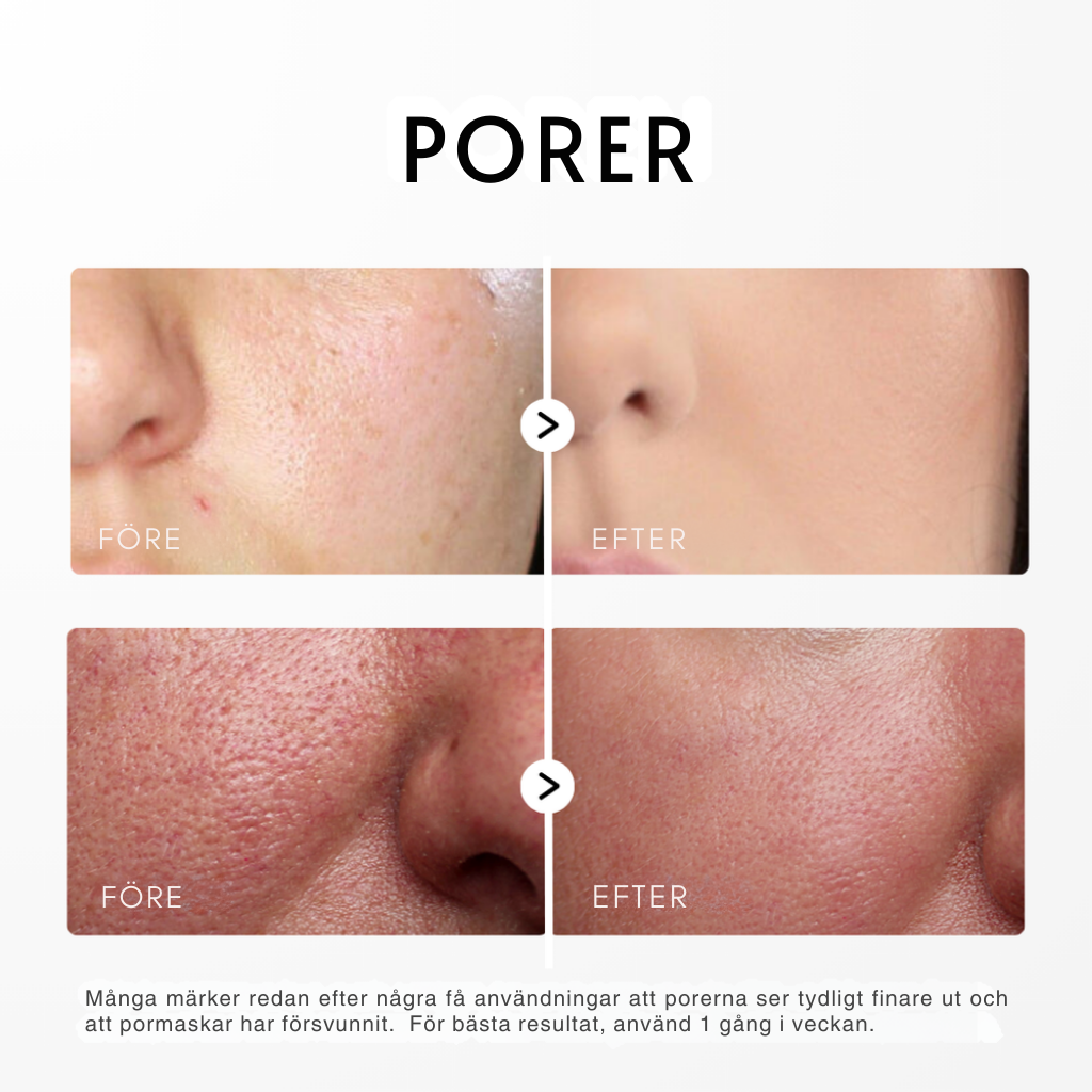 Dr. Melaxin -  Rice Peel Glow Serum (Svart/Vit Ris)