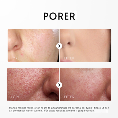 Dr. Melaxin -  Rice Peel Glow Serum (Svart/Vit Ris)