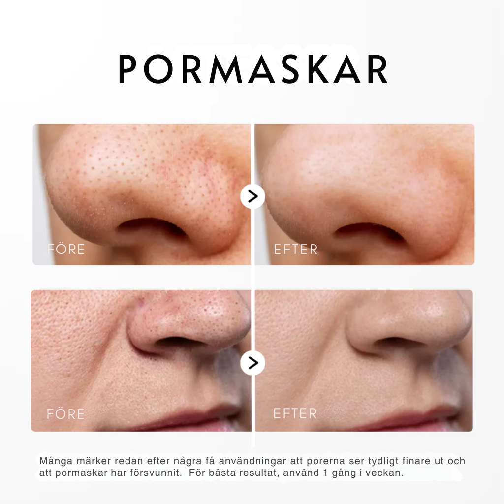 Dr. Melaxin -  Rice Peel Glow Serum (Svart/Vit Ris)