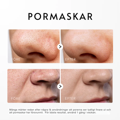 Dr. Melaxin -  Rice Peel Glow Serum (Svart/Vit Ris)